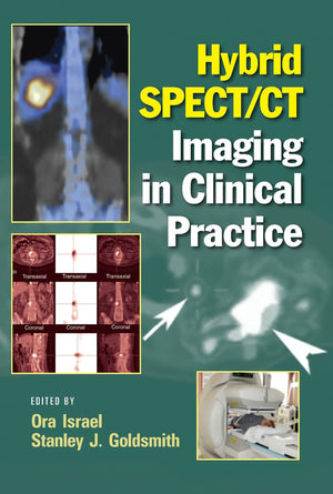 Hybrid Spect/Ct Imaging In Clinical Practice,Used