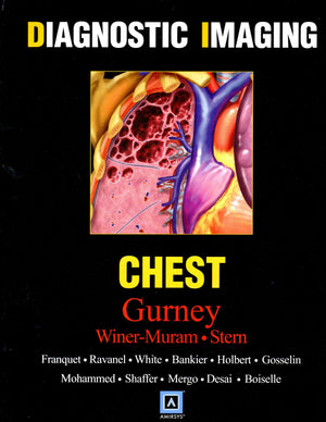 Diagnostic Imaging: Chest,Used