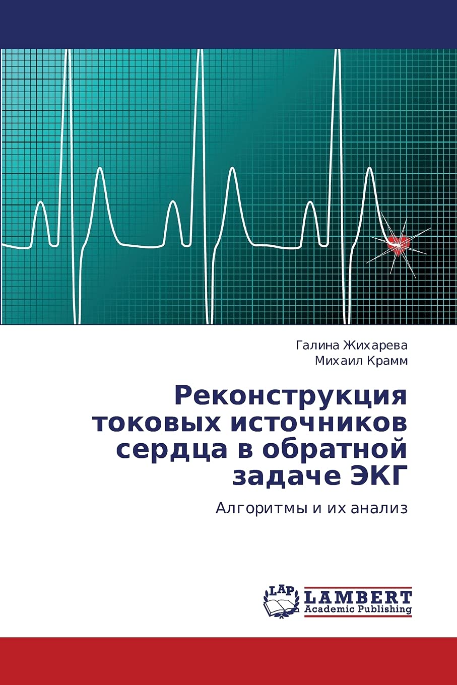 Rekonstruktsiya tokovykh istochnikov serdtsa v obratnoy zadache EKG: Algoritmy i ikh analiz (Russian Edition),Used