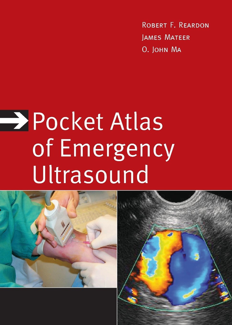 Pocket Atlas of Emergency Ultrasound (Atlas Series),Used