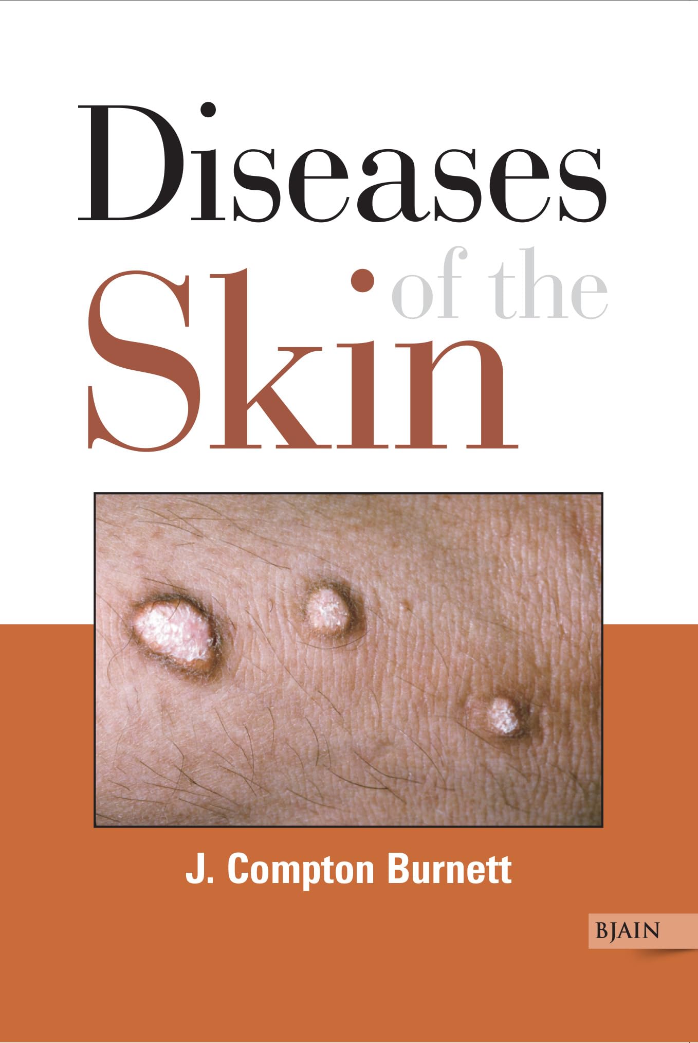 Diseases Of The Skin Their Constitutional Nature & Homeopathic Cure