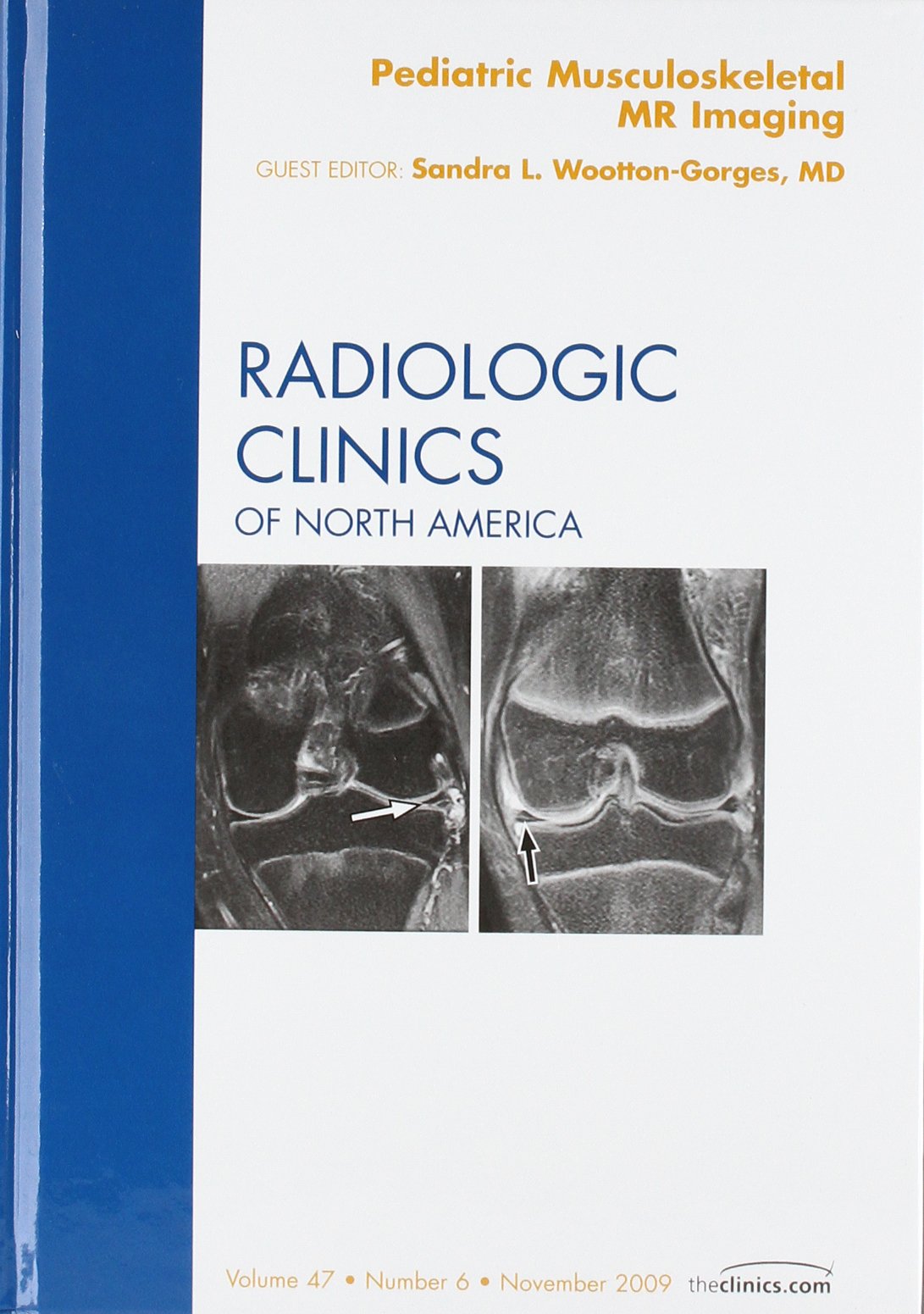 Pediatric Musculoskeletal MR Imaging, An Issue of Radiologic Clinics of North America (Volume 476) (The Clinics: Radiology, Vol,Used