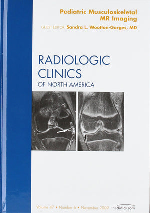 Pediatric Musculoskeletal MR Imaging, An Issue of Radiologic Clinics of North America (Volume 476) (The Clinics: Radiology, Vol,Used