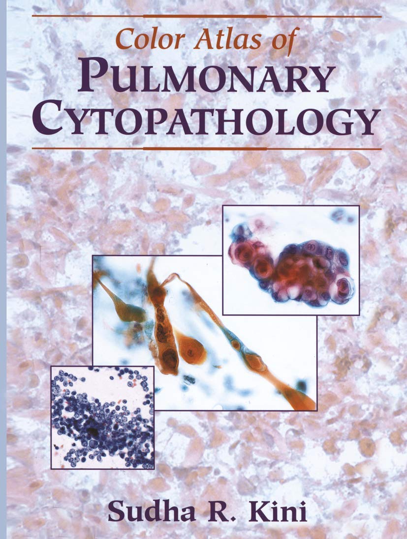 Color Atlas of Pulmonary Cytopathology,New
