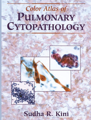 Color Atlas of Pulmonary Cytopathology,Used
