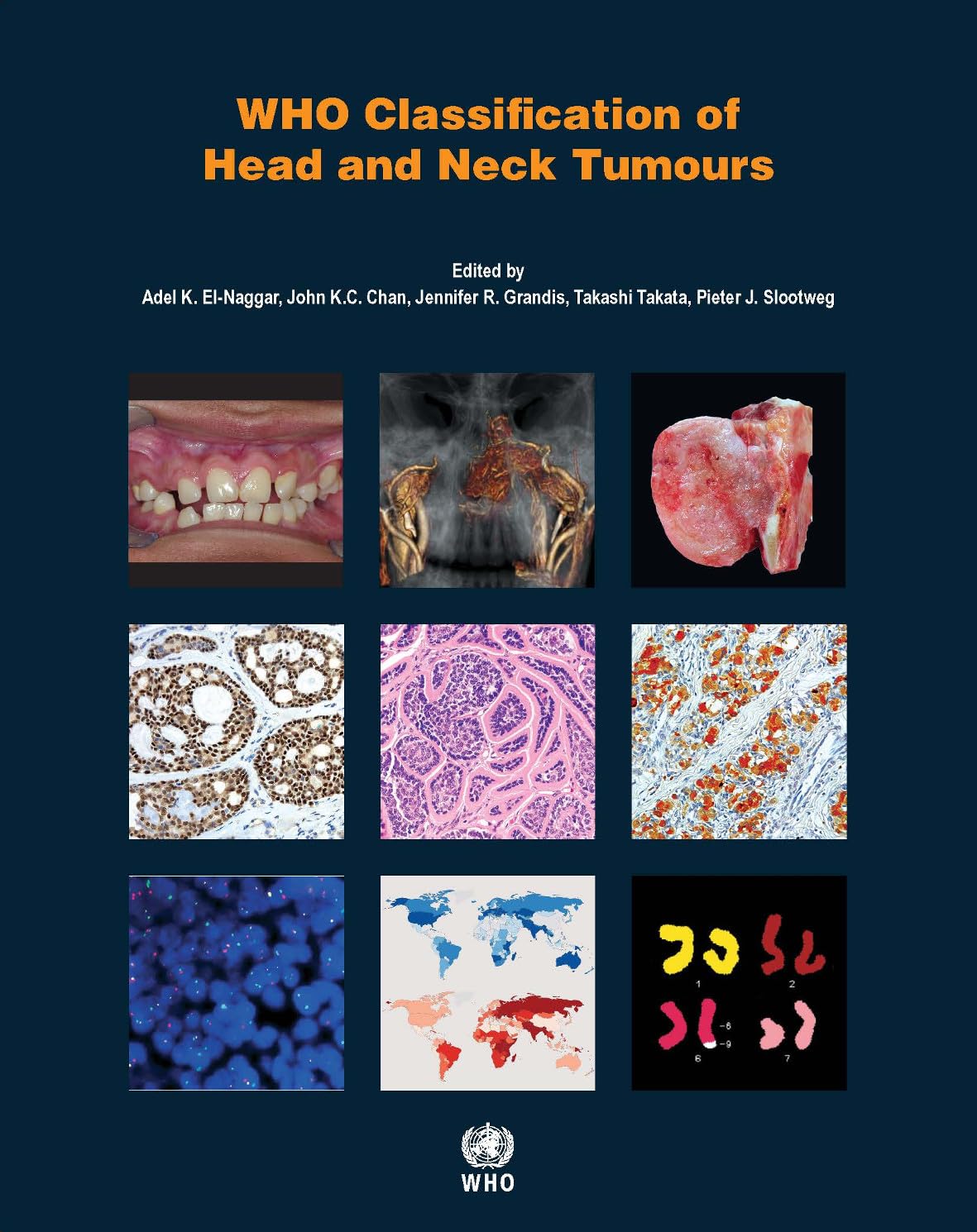 WHO Classification of Head and Neck Tumours (WHO Classification of Tumours),Used