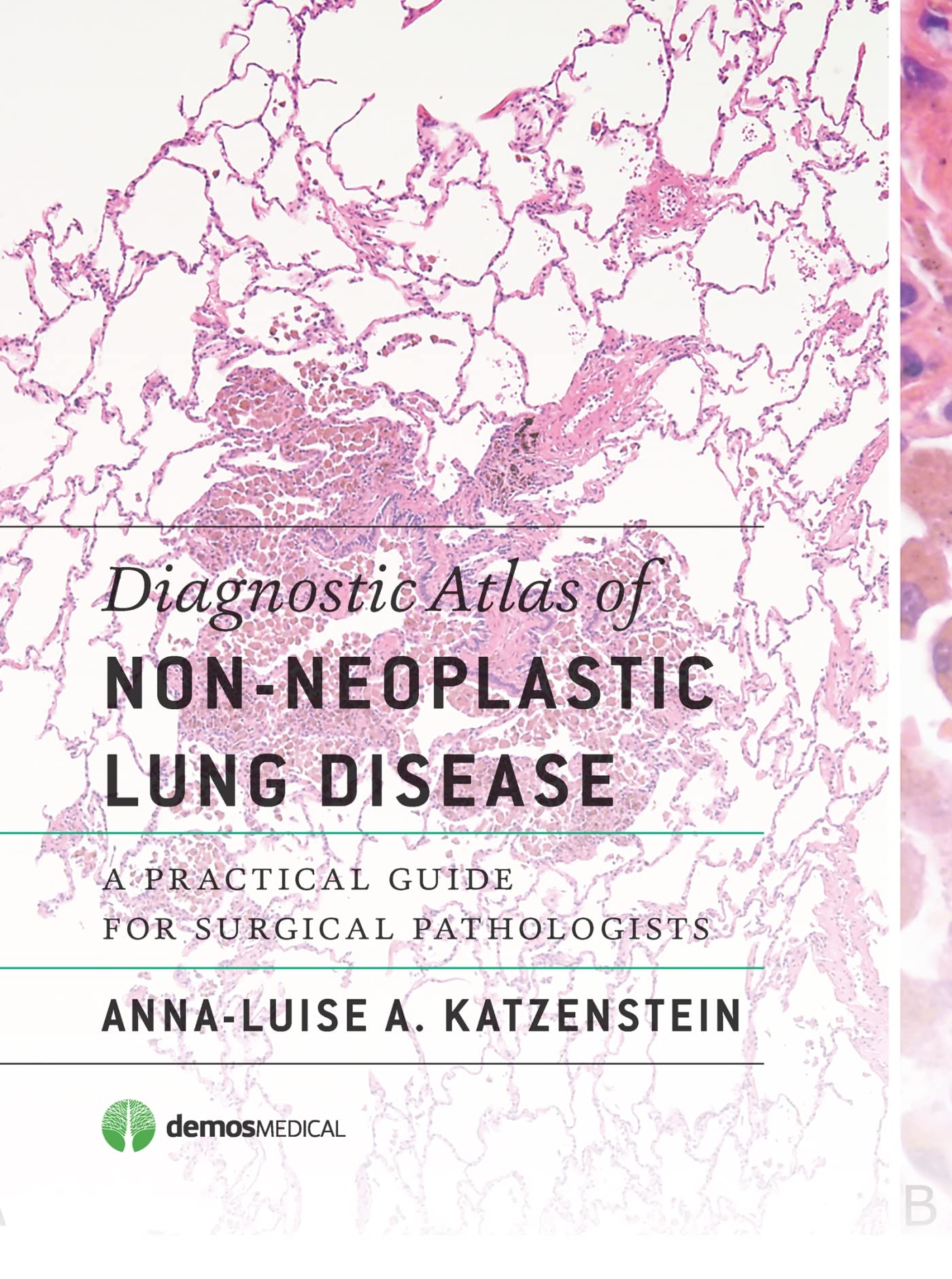 Diagnostic Atlas of NonNeoplastic Lung Disease: A Practical Guide for Surgical Pathologists,Used