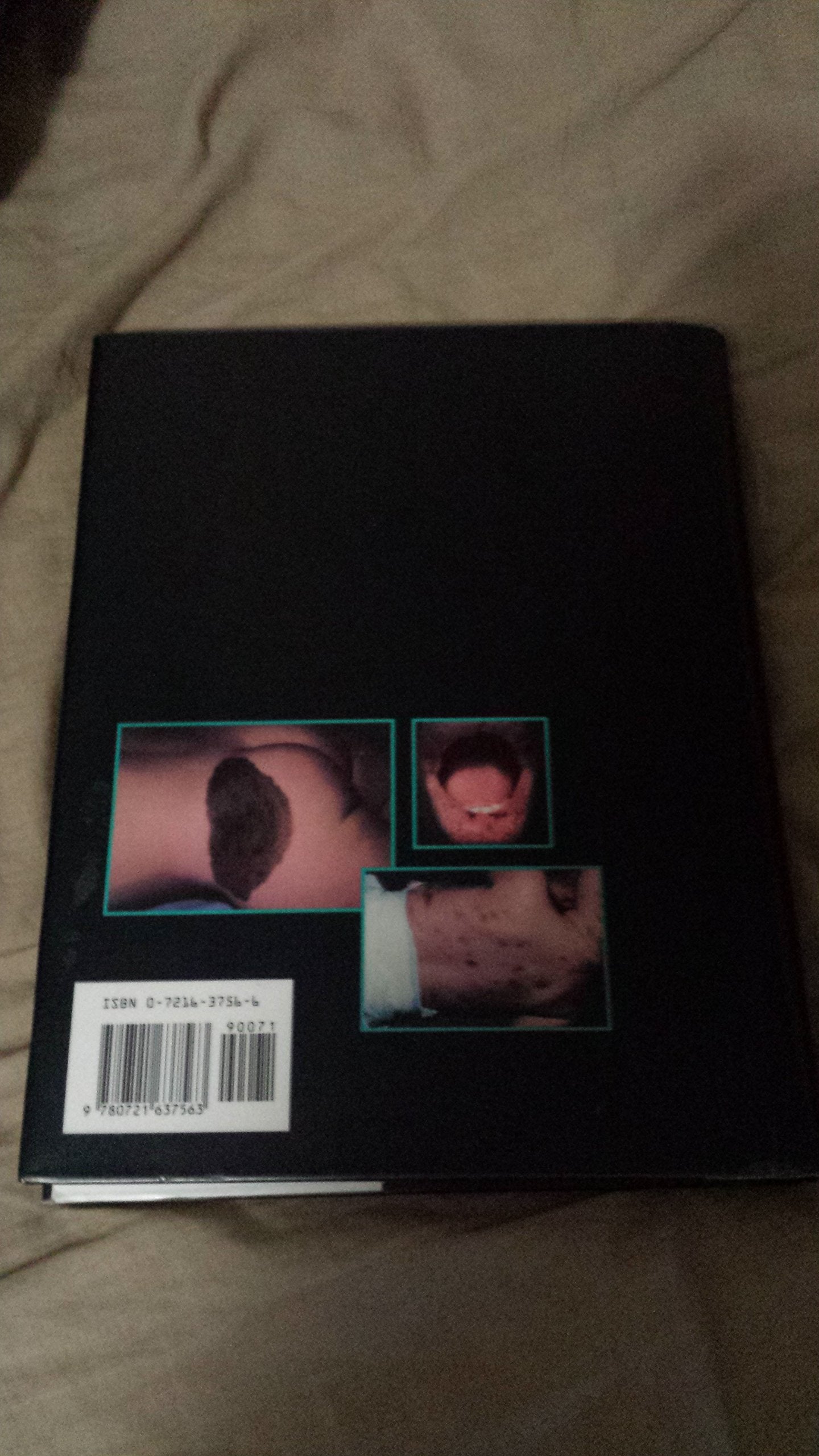 Color Atlas Of Dermatology