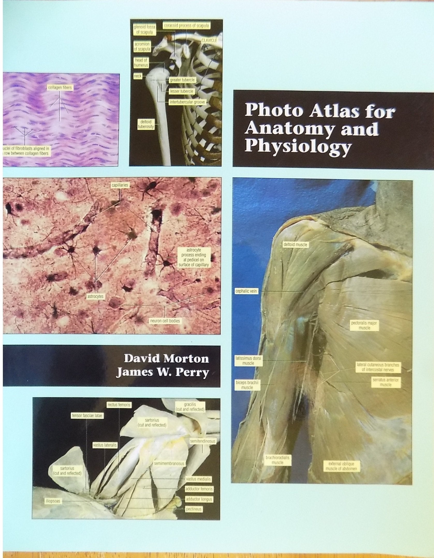 Photo Atlas for Anatomy and Physiology,Used