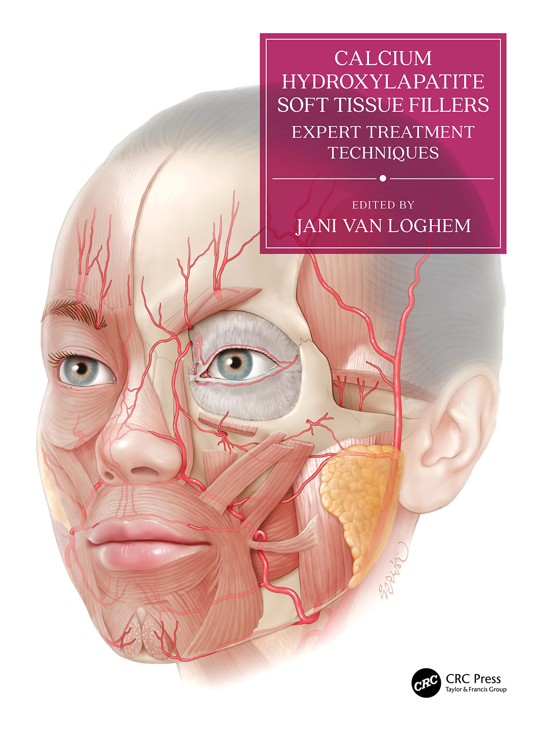 Calcium Hydroxylapatite Soft Tissue Fillers: Expert Treatment Techniques (UMA Academy Series in Aesthetic Medicine)