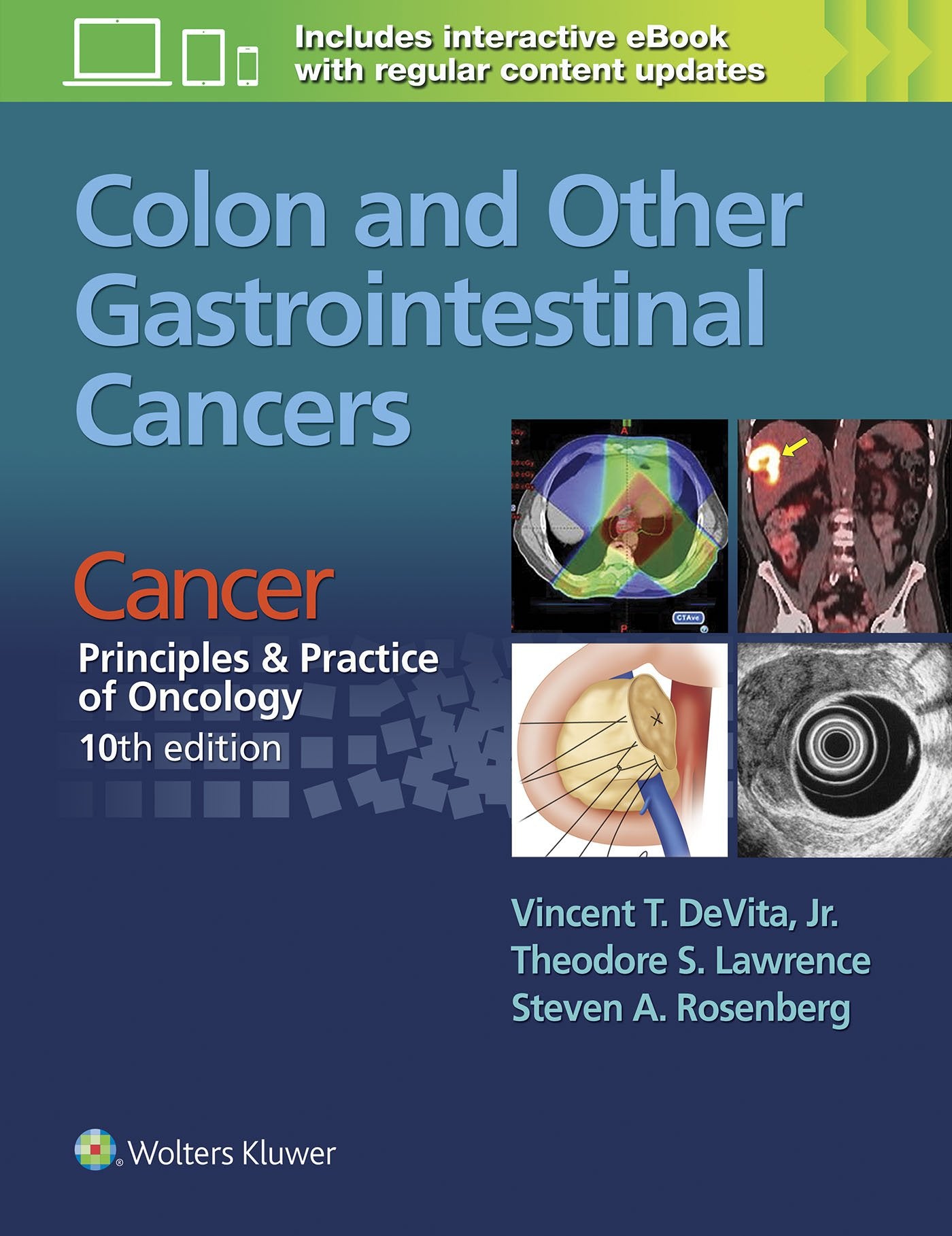 Colon and Other Gastrointestinal Cancers: Cancer: Principles & Practice of Oncology, 10th edition