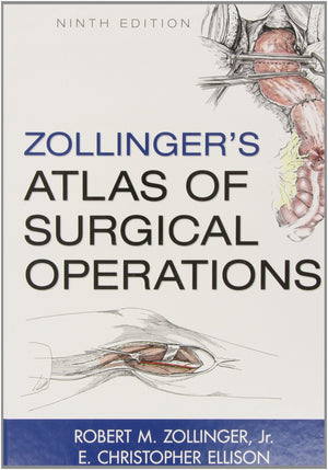Zollingers Atlas of Surgical Operations, 9th Edition