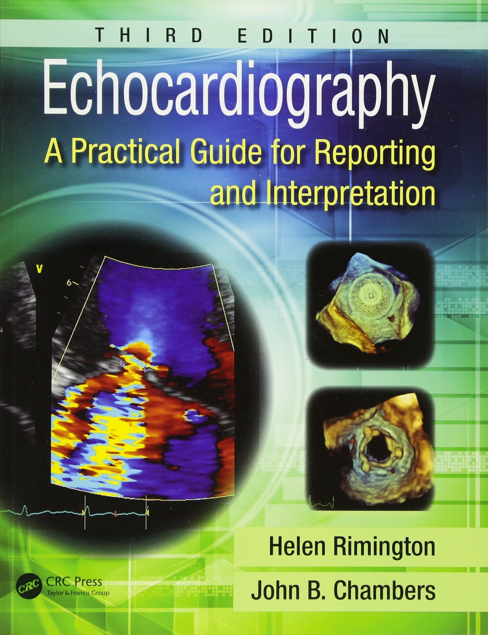 Echocardiography: A Practical Guide For Reporting And Interpretation, Third Edition