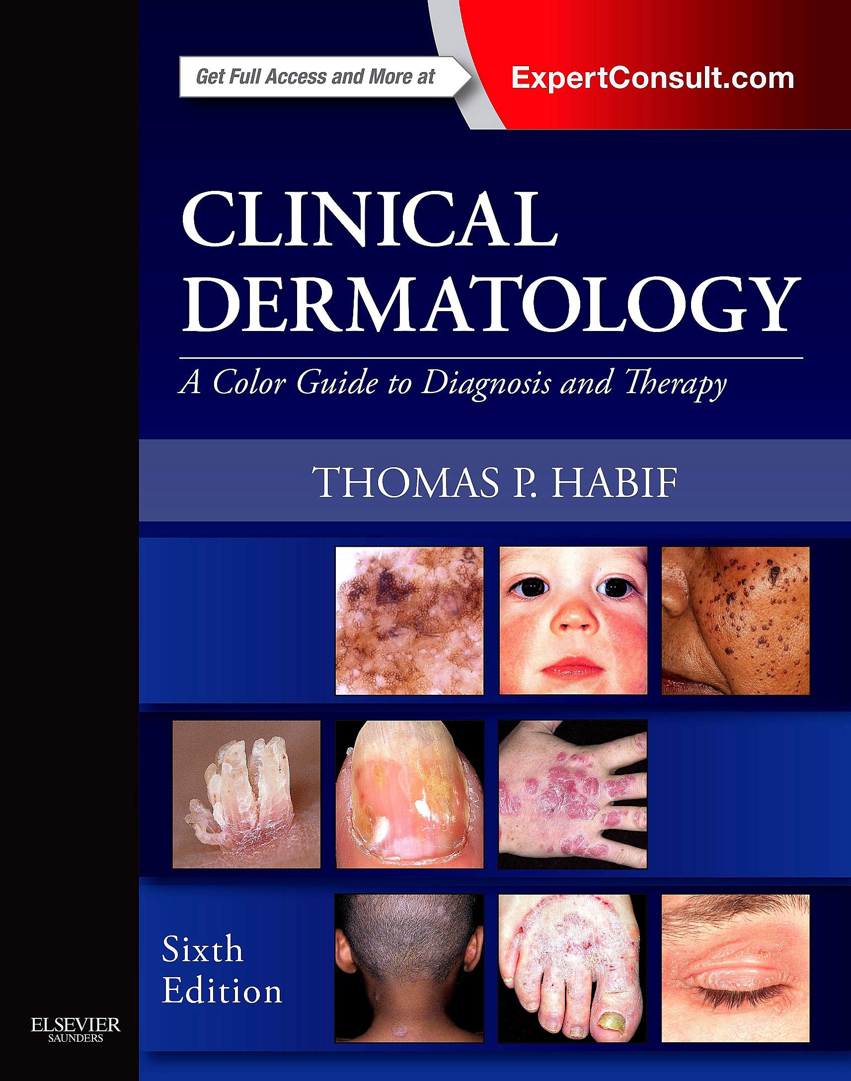 Clinical Dermatology: A Color Guide to Diagnosis and Therapy, 6e,Used