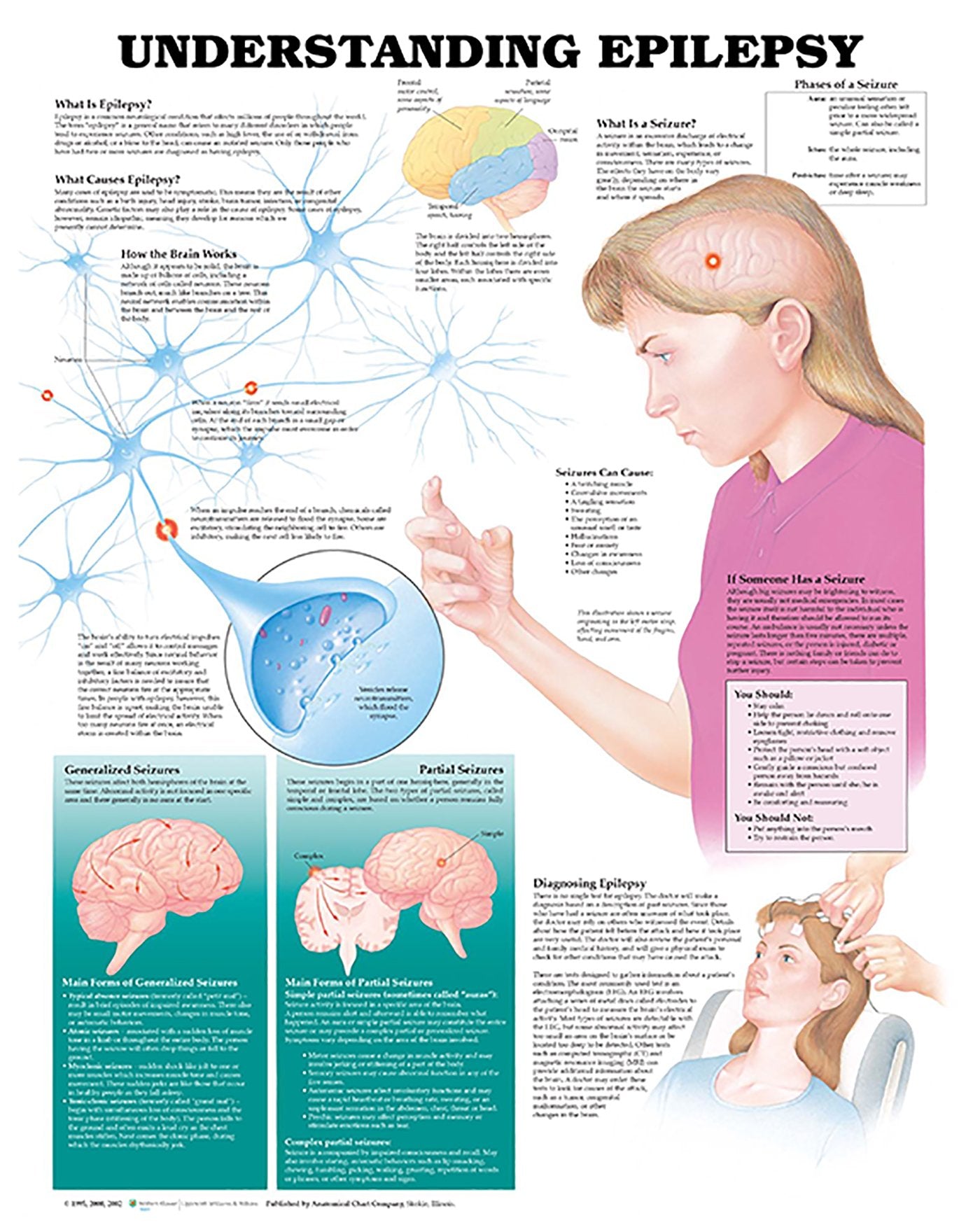 Understanding Epilepsy Anatomical Chart,New