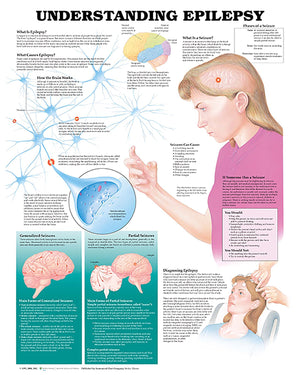 Understanding Epilepsy Anatomical Chart,New