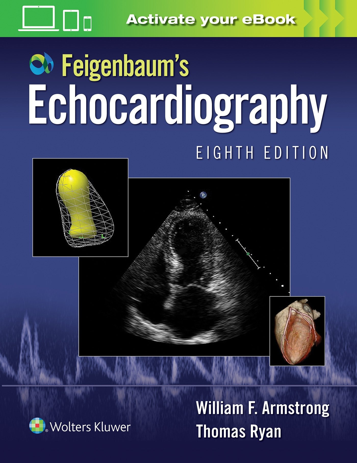 Feigenbaum'S Echocardiography
