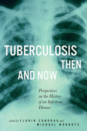 Tuberculosis Then And Now: Perspectives On The History Of An Infectious Disease (Volume 36) (Mcgillqueens/Ams Healthcare Studie,New