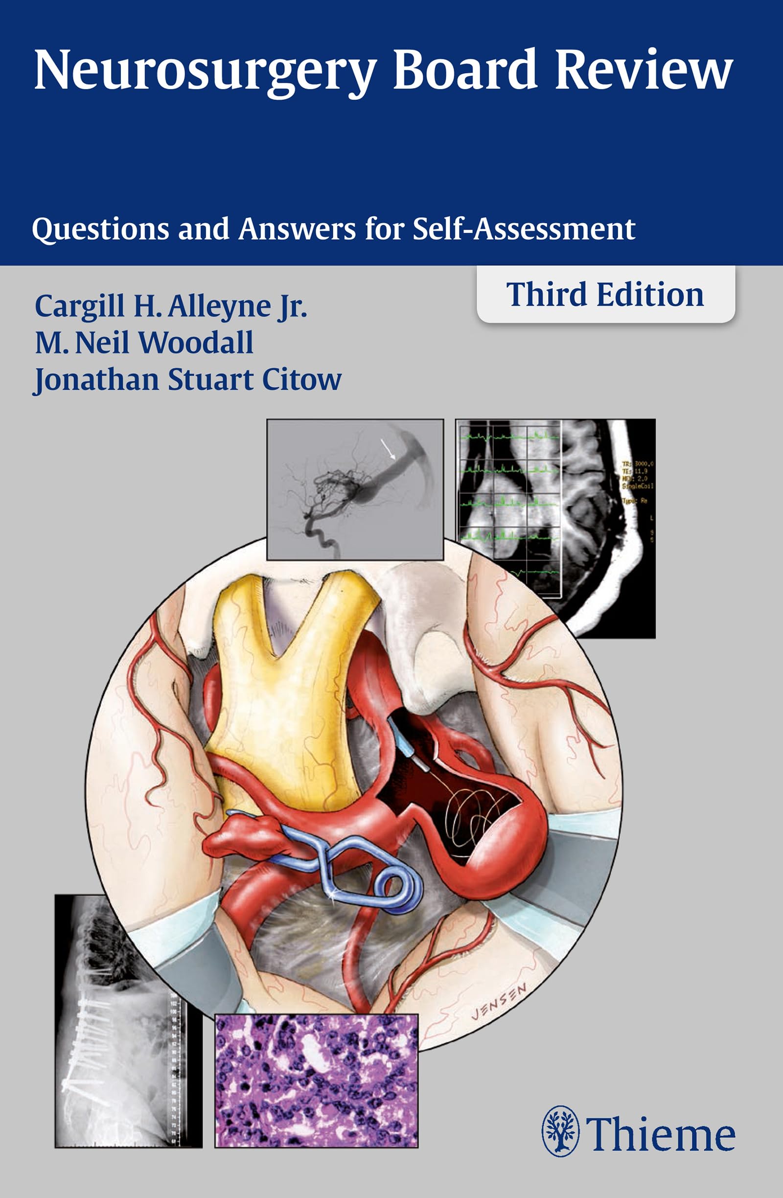 Neurosurgery Board Review: Questions and Answers for SelfAssessment,Used