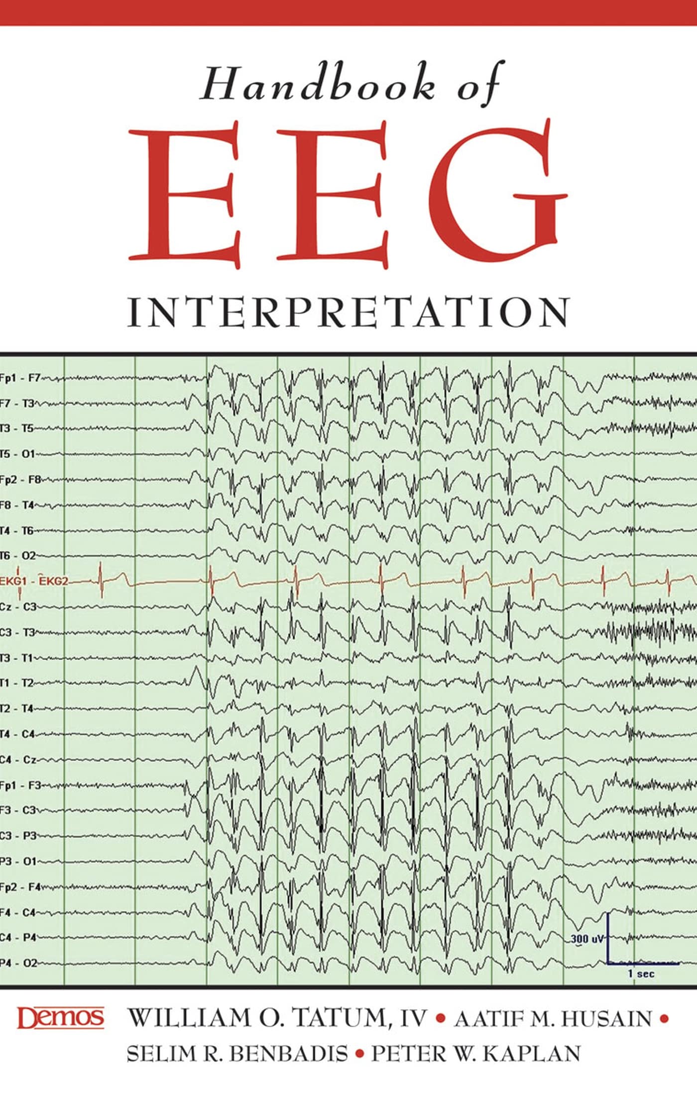Handbook of EEG Interpretation,Used