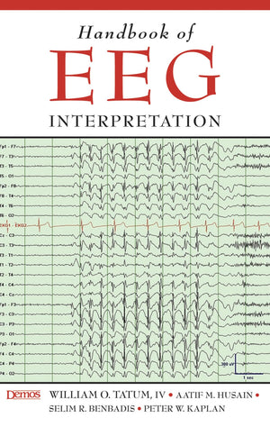 Handbook of EEG Interpretation,Used