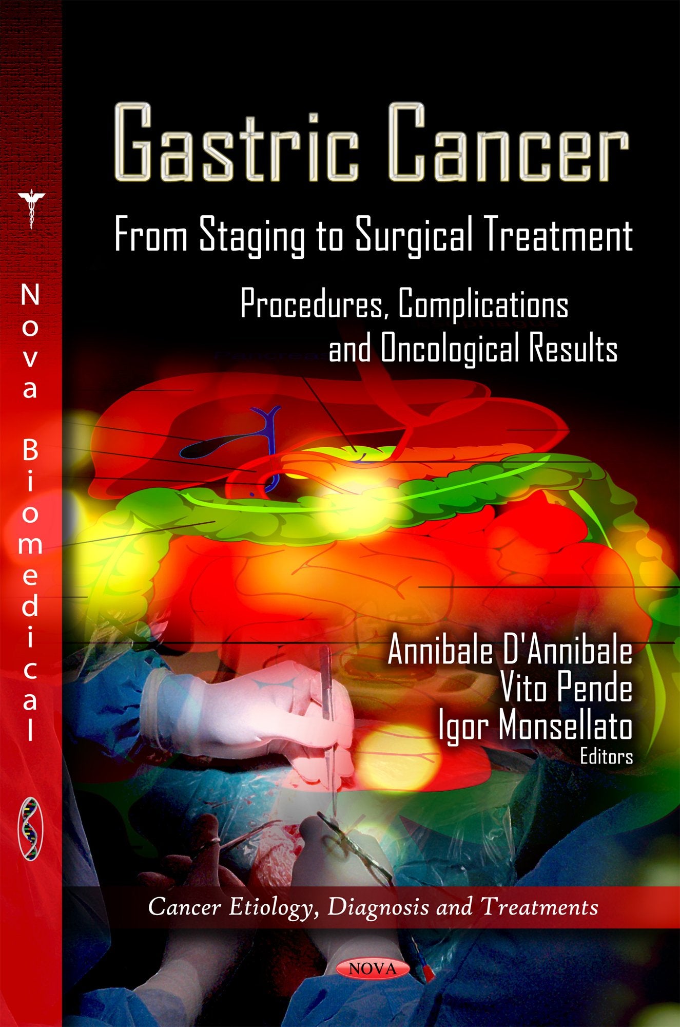 Gastric Cancer: From Staging To Surgical Treatment, Procedures, Complications And Oncological Results (Cancer Etiology Diagnosis,Used