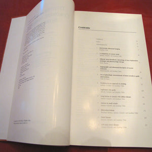 Techniques in Coronary Artery Stenting (Book with CDROM),Used