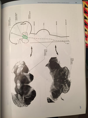 Neuroanatomy: An Atlas Of Structures, Sections, And Systems (Neuroanatomy: An Atlas Of Strutures, Sections, And Systems (Haines),Used
