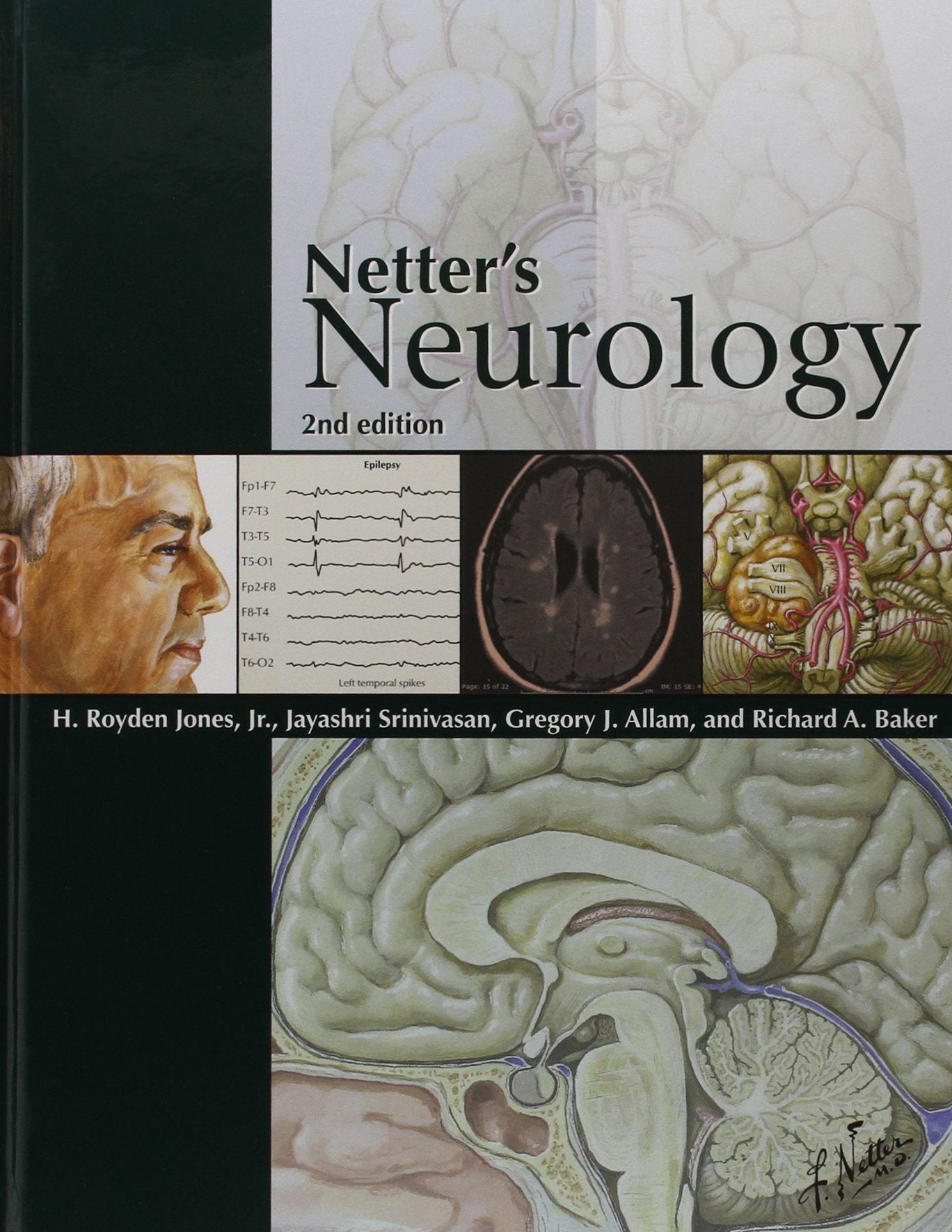 Netter's Neurology, 2e,Used