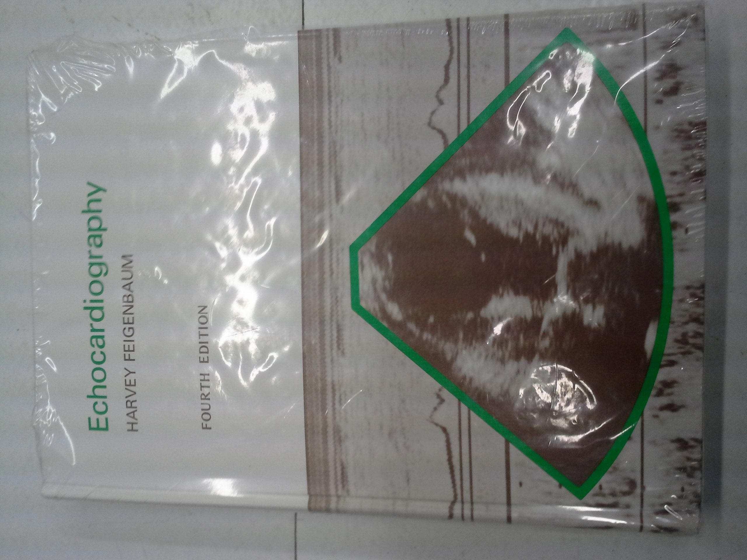 Echocardiography,Used