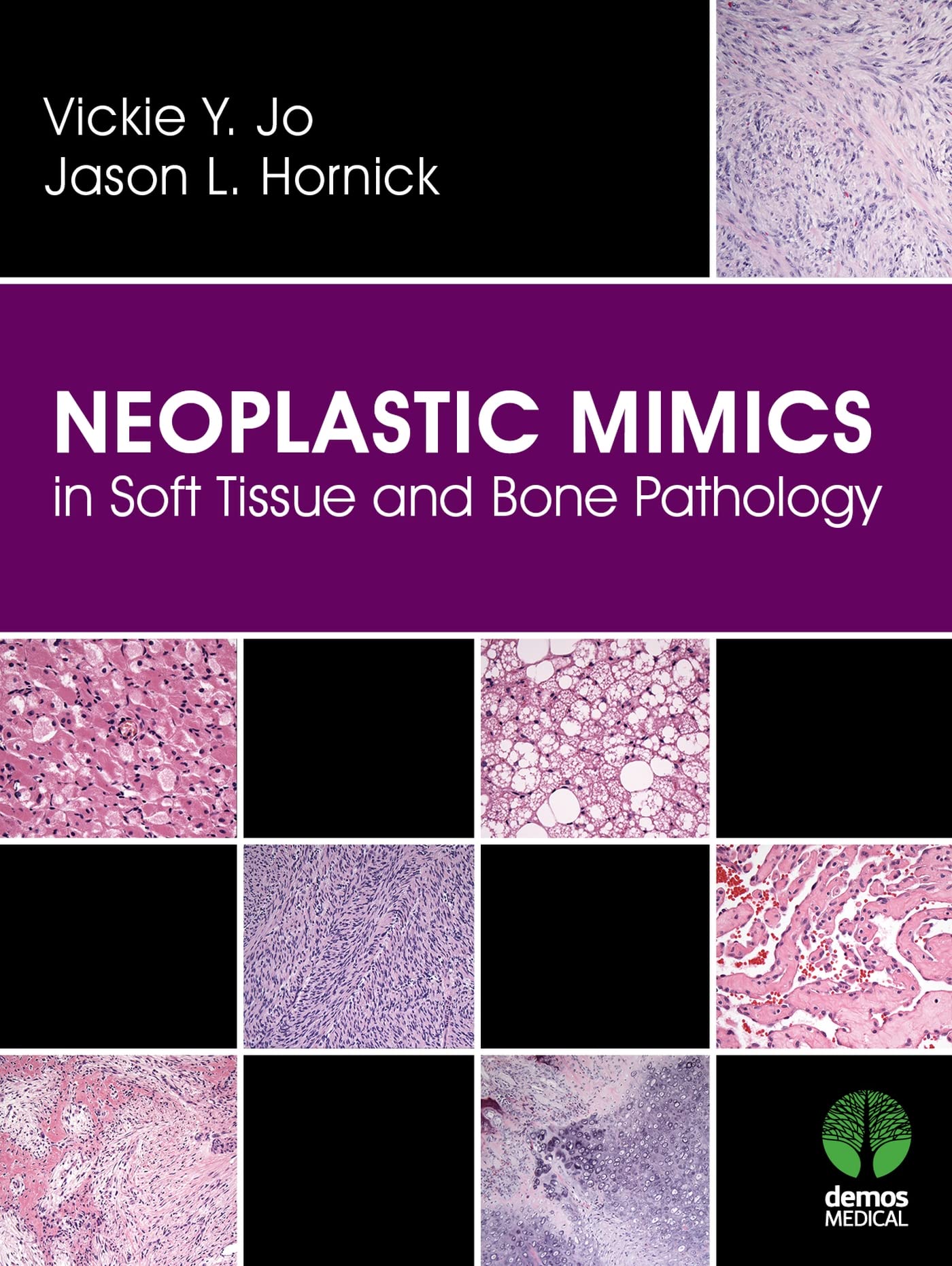 Neoplastic Mimics in Soft Tissue and Bone Pathology (Pathology of Neoplastic Mimics),Used