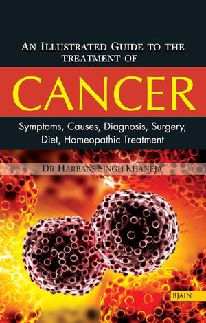 An Illustrated Guide To The Treatment Of Cancer Symptoms, Causes, Diagnosis, Surgery, Diet, Homeopathic Treatment