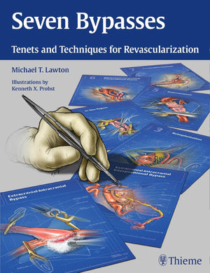 Seven Bypasses: Tenets and Techniques for Revascularization,Used