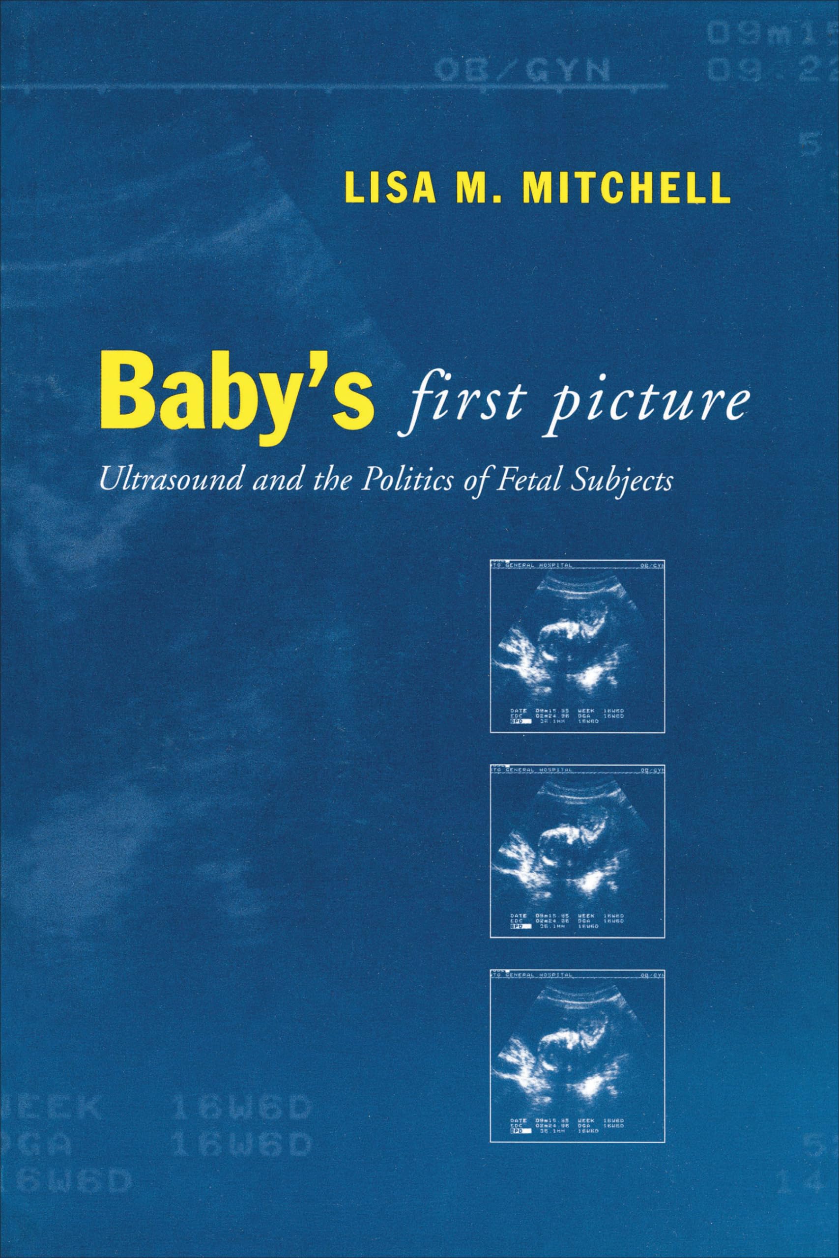 Baby's First Picture: Ultrasound and the Politics of Fetal Subjects,Used