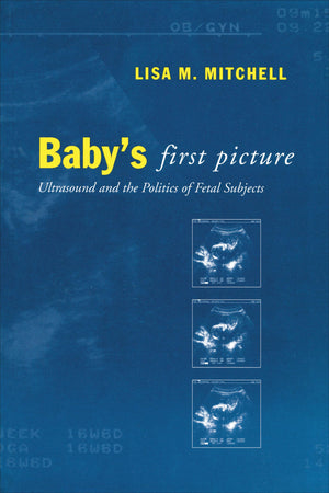 Babys First Picture: Ultrasound and the Politics of Fetal Subjects