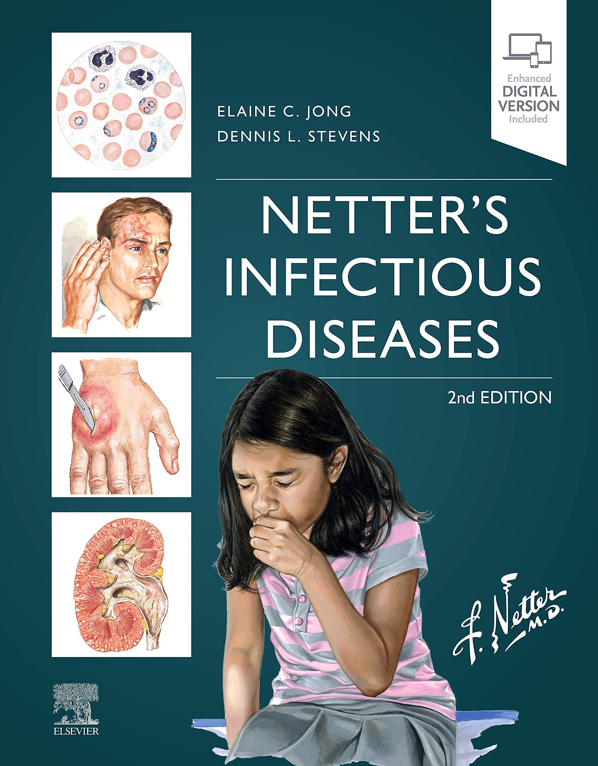 Netter'S Infectious Diseases