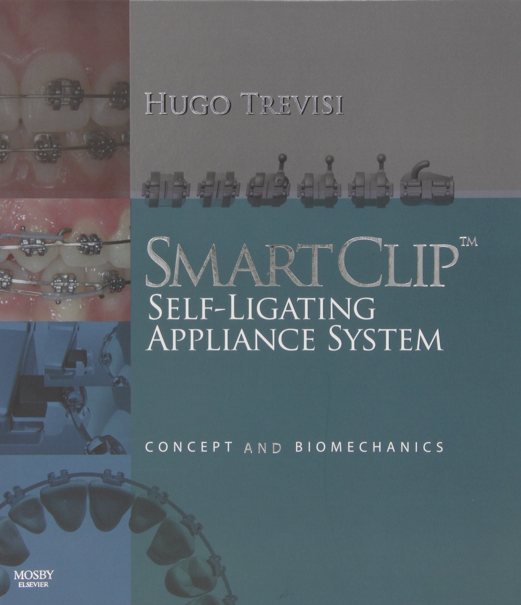 SmartClip SelfLigating Appliance System: Concept and Biomechanics,Used