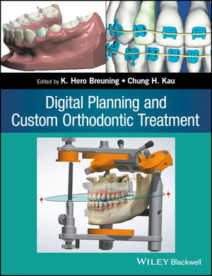 Digital Planning and Custom Orthodontic Treatment,Used