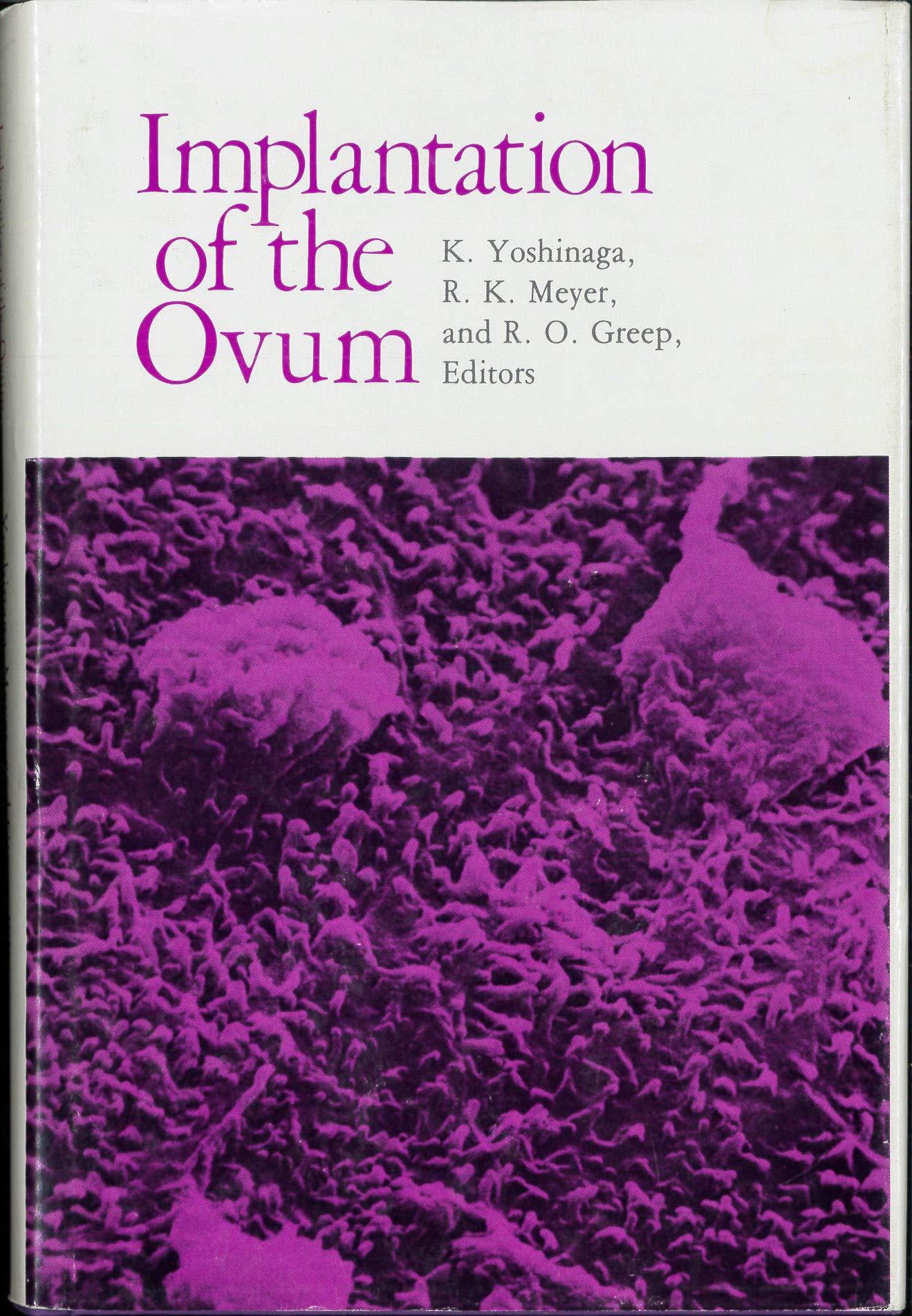 Implantation Of The Ovum,Used