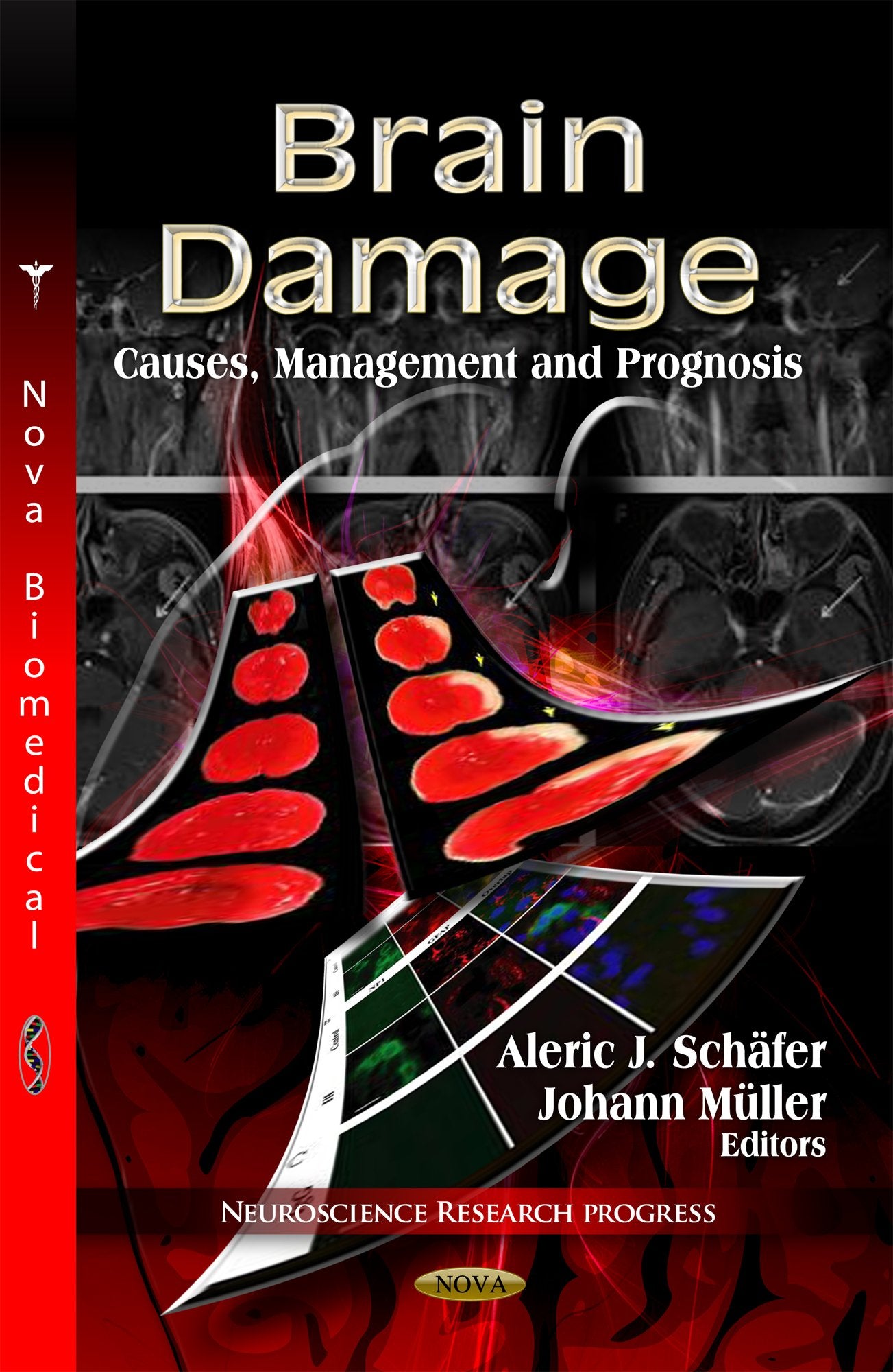 Brain Damage: Causes, Management And Prognosis (Neuroscience Research Progress),Used