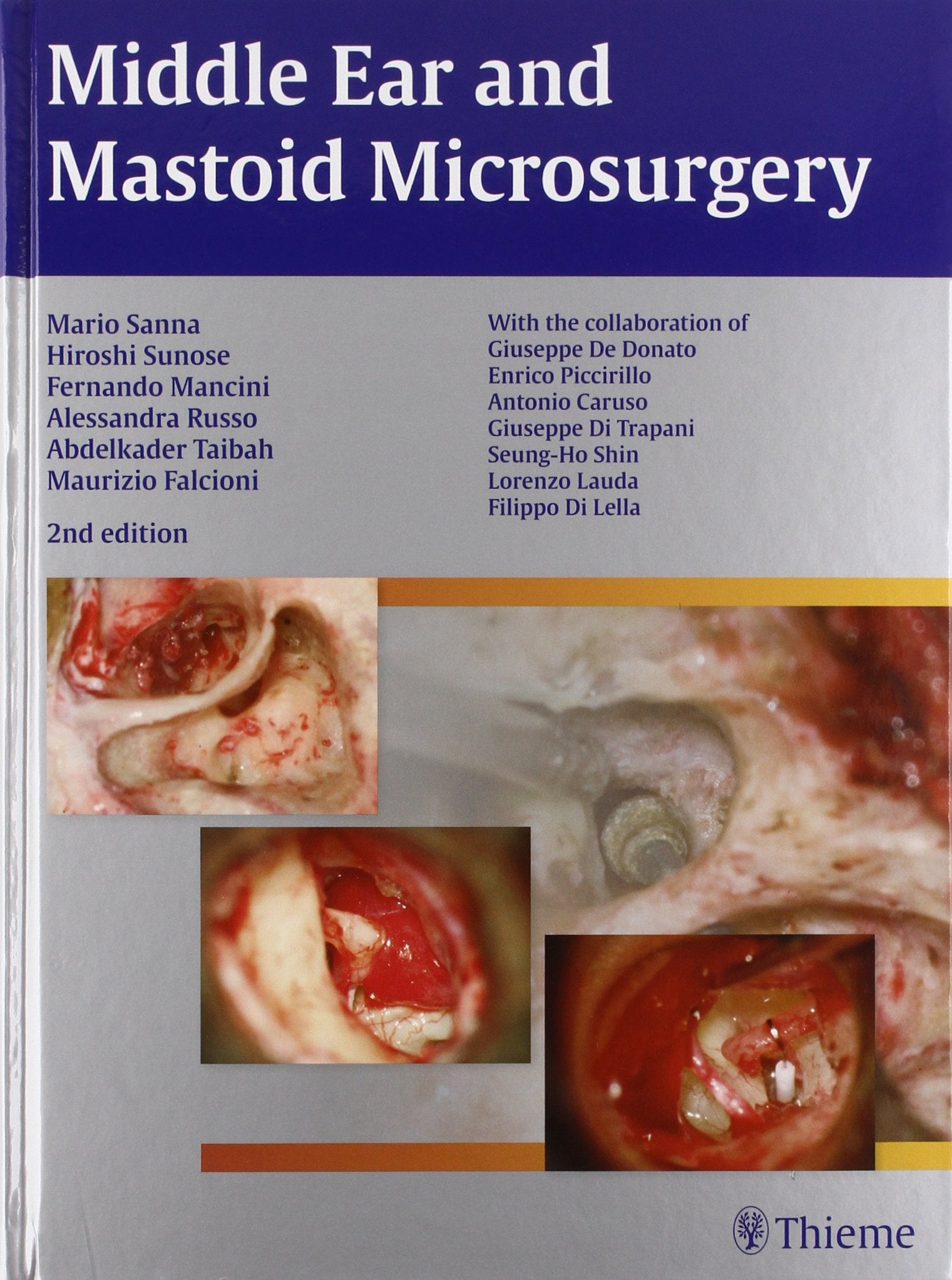 Middle Ear and Mastoid Microsurgery