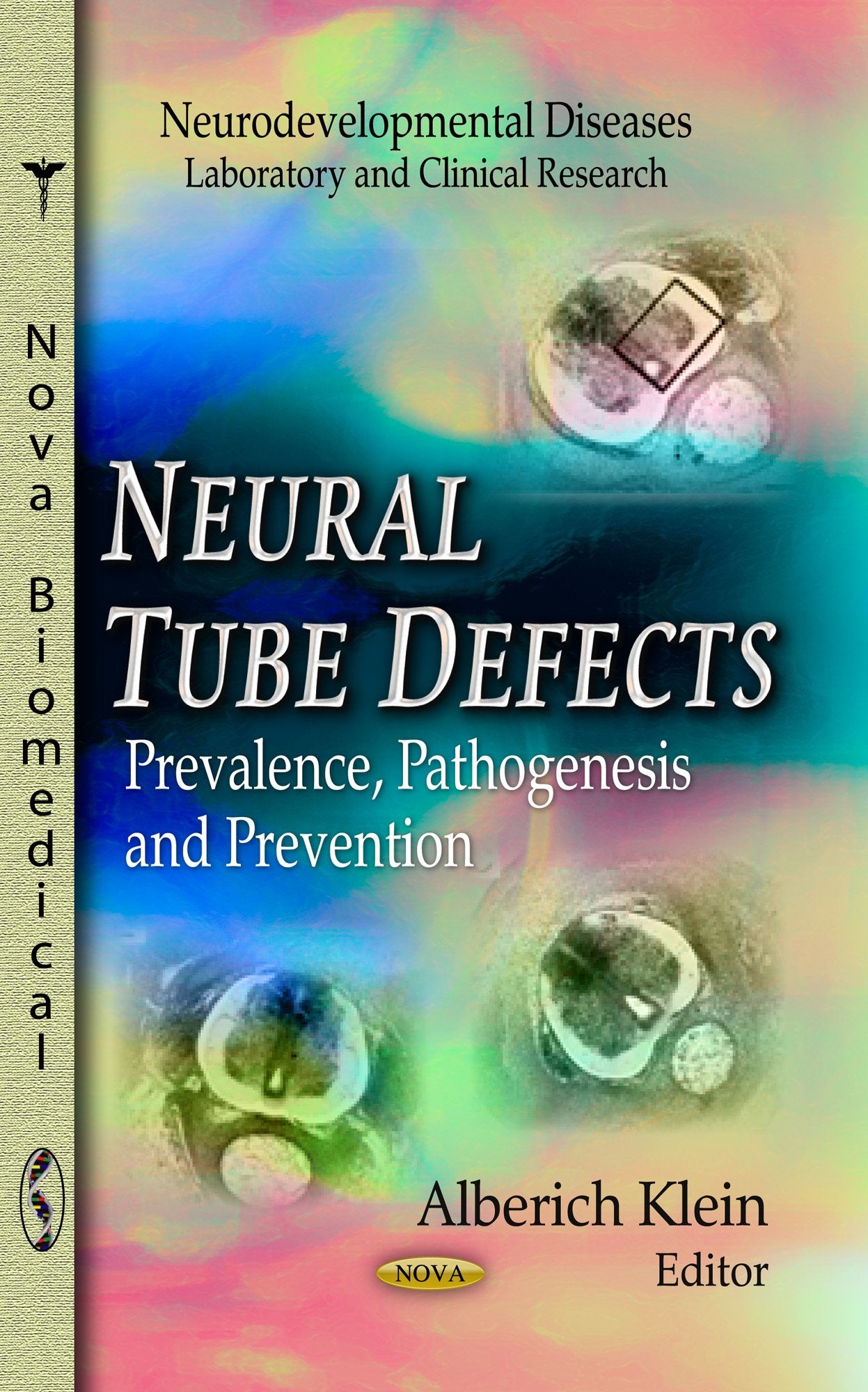 Neural Tube Defects: Prevalence, Pathogenesis And Prevention (Neurodevelopmental Diseases Laboratory And Clinical Research: Neu,Used