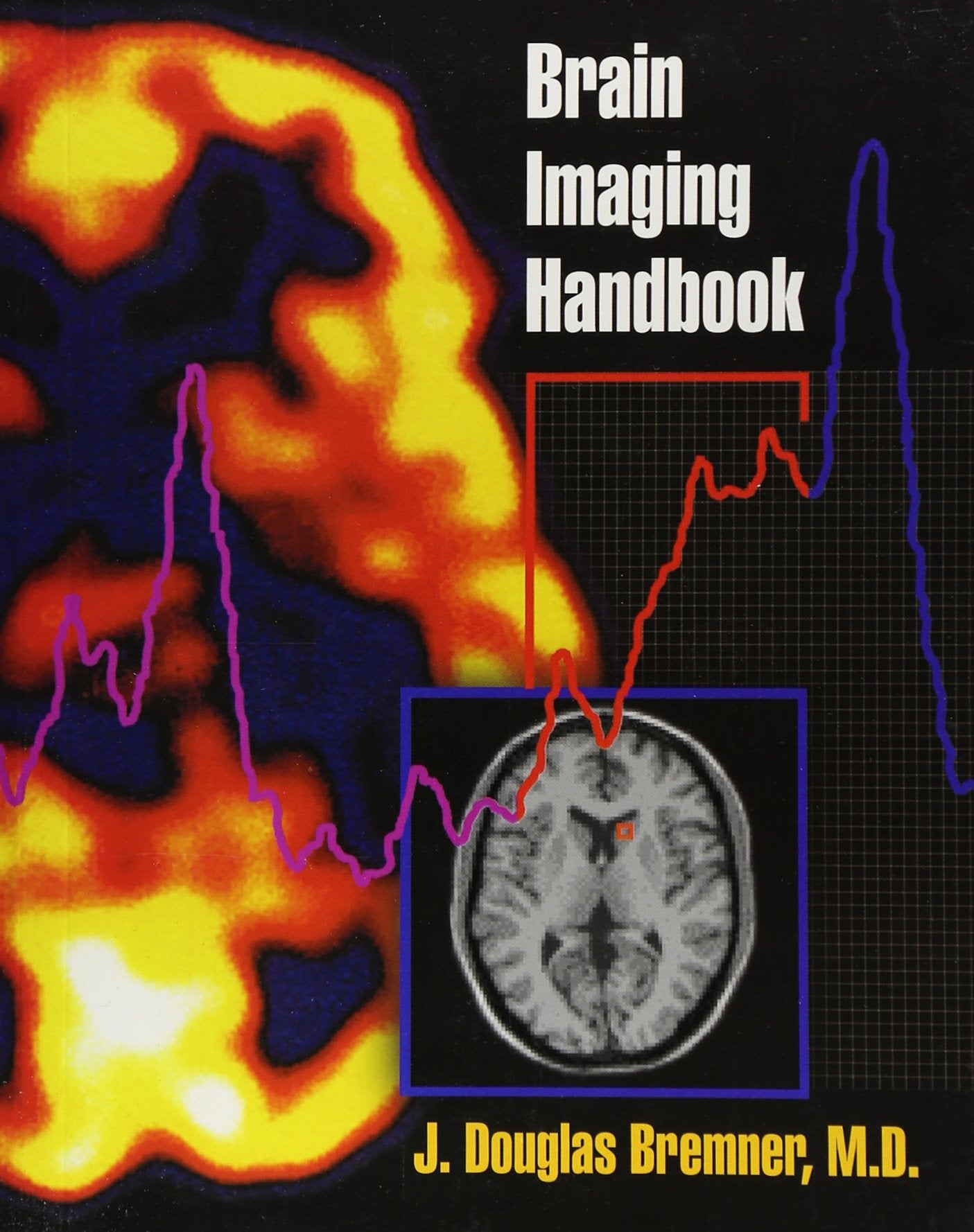 Brain Imaging Handbook,Used
