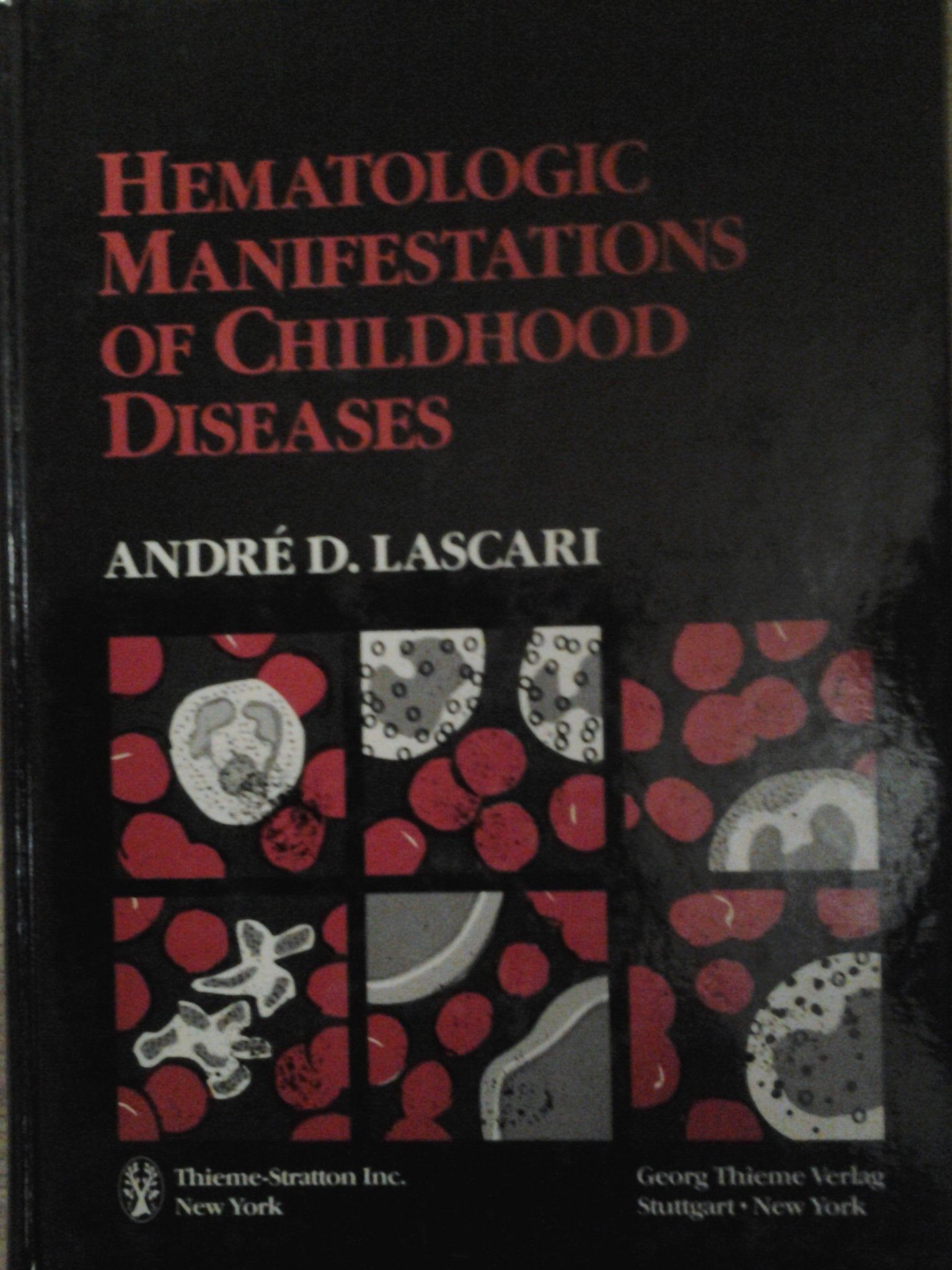 Hematologic Manifestations of Childhood Diseases,Used