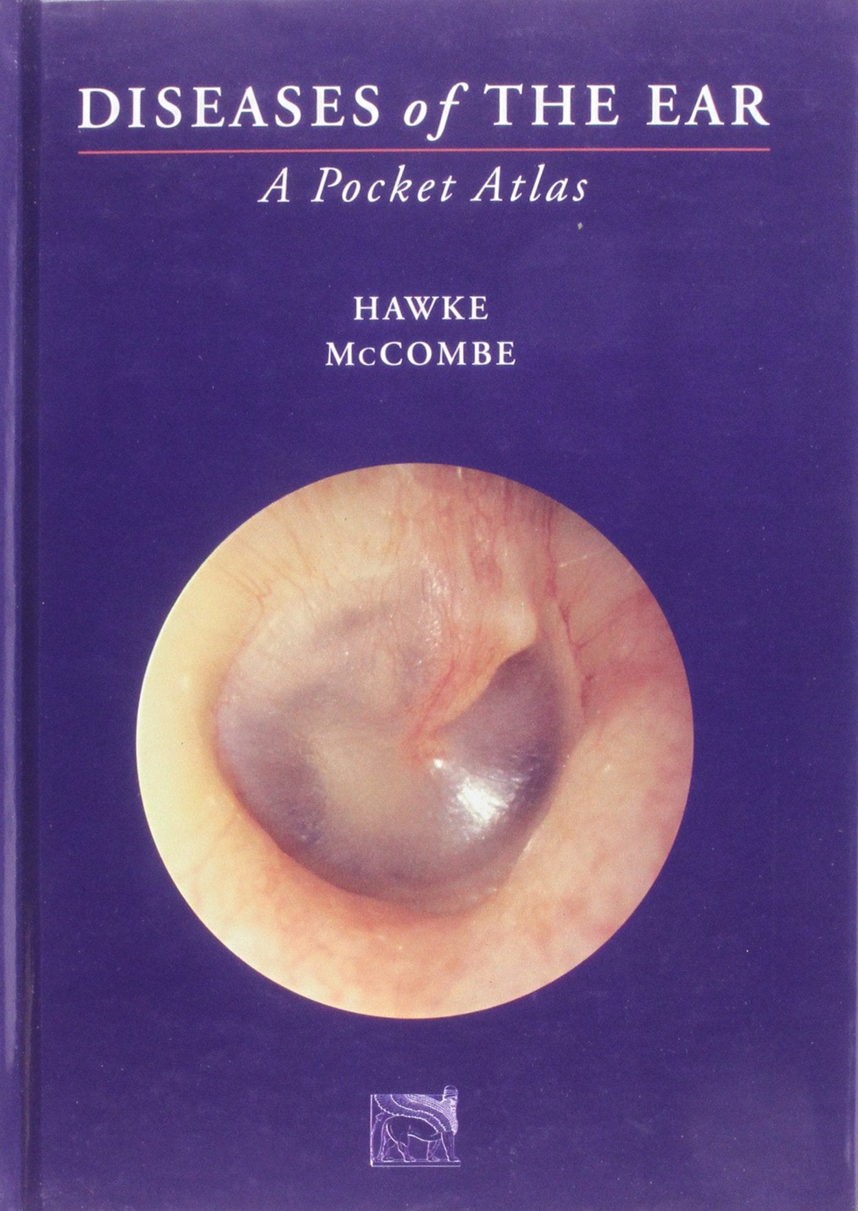 Diseases of the Ear: A Pocket Atlas,Used