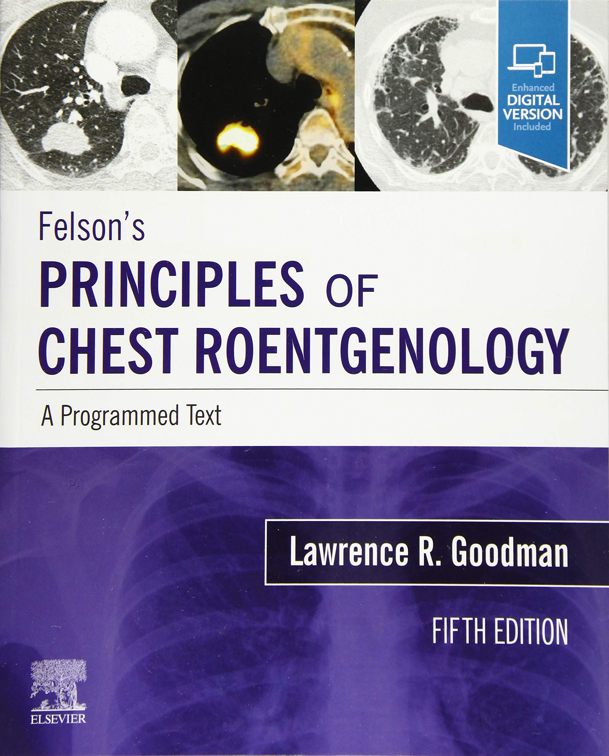 Felsons Principles of Chest Roentgenology, A Programmed Text: A Programmed Text