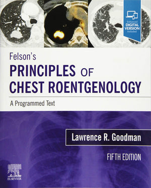 Felsons Principles of Chest Roentgenology, A Programmed Text: A Programmed Text