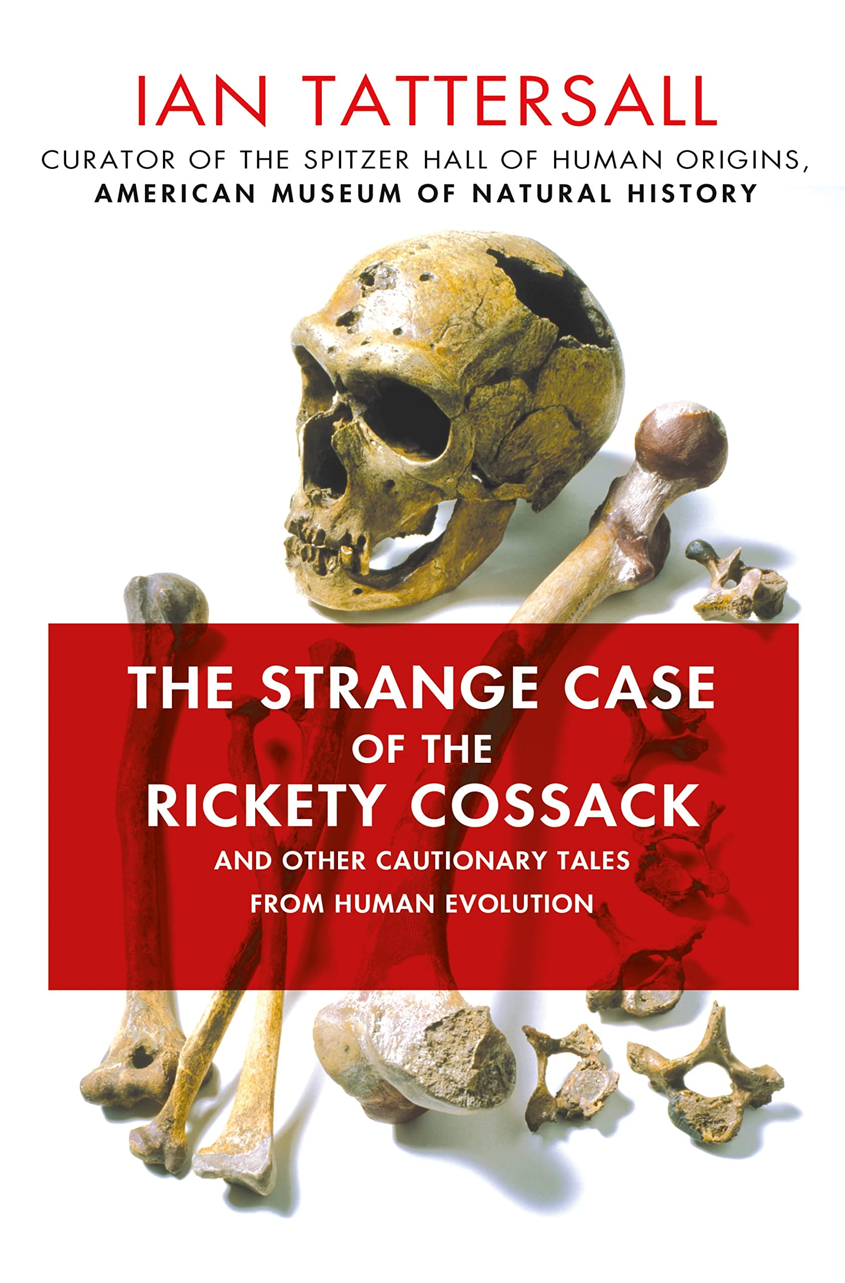 The Strange Case Of The Rickety Cossack: And Other Cautionary Tales From Human Evolution