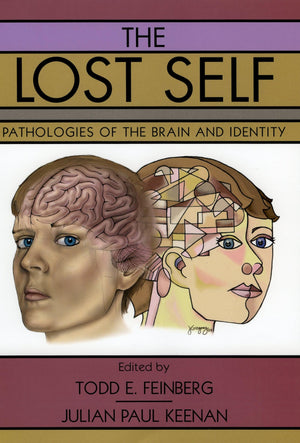 The Lost Self: Pathologies of the Brain and Identity,Used