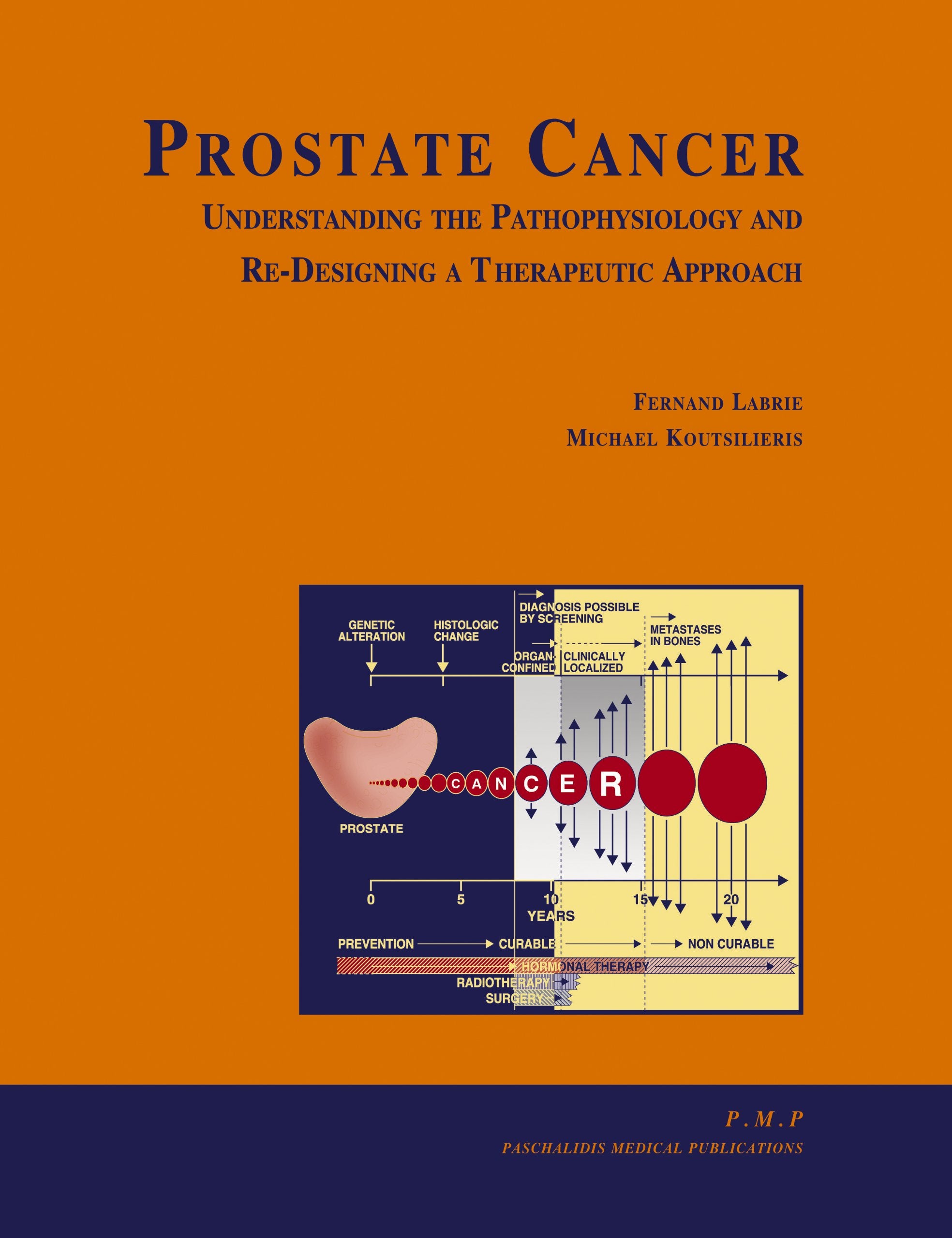 Prostate Cancer: Understanding the Pathophysiology and ReDesigning a Therapeutic Approach,Used